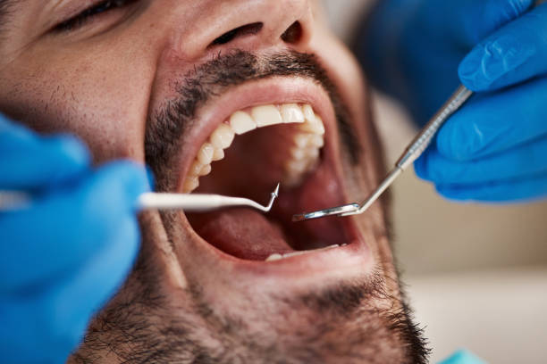 Best Emergency Dental Care for Broken or Chipped Teeth in Westville, IN