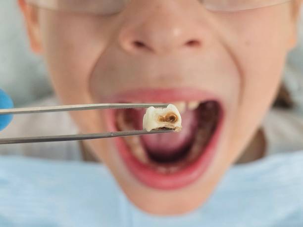 Best Pediatric Emergency Dentist in Westville, IN