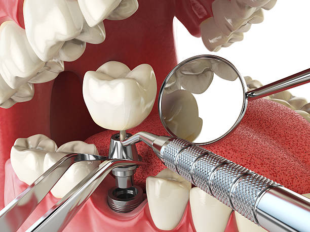 Best Cosmetic Emergency Dentistry in Westville, IN